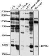 PPP2R4 Antibody - Western blot analysis of extracts of various cell lines, using PPP2R4 antibody at 1:3000 dilution. The secondary antibody used was an HRP Goat Anti-Rabbit IgG (H+L) at 1:10000 dilution. Lysates were loaded 25ug per lane and 3% nonfat dry milk in TBST was used for blocking. An ECL Kit was used for detection and the exposure time was 20s.