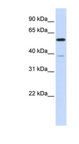 PPP2R5A Antibody - PPP2R5A antibody Western blot of Transfected 293T cell lysate. This image was taken for the unconjugated form of this product. Other forms have not been tested.