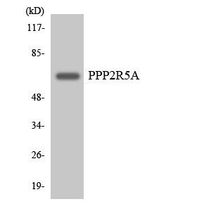 PPP2R5A Antibody - Western blot analysis of the lysates from HeLa cells using PPP2R5A antibody.