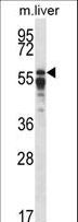PPP2R5A Antibody - PPP2R5A Antibody western blot of mouse liver tissue lysates (35 ug/lane). The PPP2R5A antibody detected the PPP2R5A protein (arrow).