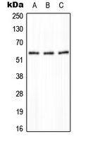 PPP2R5A Antibody - Western blot analysis of PPP2R5A expression in HeLa (A); NIH3T3 (B); H9C2 (C) whole cell lysates.
