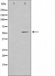 PPP2R5A Antibody - Western blot analysis of extracts of HuvEc cells using PPP2R5A antibody. The lane on the left is treated with the antigen-specific peptide.