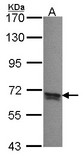 PPP2R5B Antibody - Sample (30 ug of whole cell lysate). A: A431 . 7.5% SDS PAGE. PPP2R5B antibody. PPP2R5B antibody diluted at 1:1000.