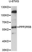 PPP2R5B Antibody - Western blot analysis of extracts of U-87MG cells, using PPP2R5B antibody at 1:1000 dilution. The secondary antibody used was an HRP Goat Anti-Rabbit IgG (H+L) at 1:10000 dilution. Lysates were loaded 25ug per lane and 3% nonfat dry milk in TBST was used for blocking. An ECL Kit was used for detection and the exposure time was 1s.