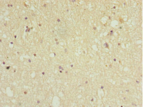 PPP2R5C Antibody - Immunohistochemistry of paraffin-embedded human brain tissue at dilution 1:100