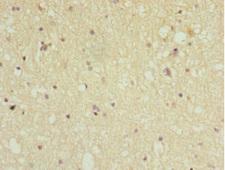 PPP2R5C Antibody - Immunohistochemistry of paraffin-embedded human brain tissue at dilution 1:100
