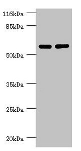 PPP2R5C Antibody - Western blot All Lanes:PPP2R5C antibody at 1.31ug/ml Lane 1:MM231 whole cell lysate Lane 2:K562 whole cell lysate Secondary Goat polyclonal to rabbit at 1/10000 dilution Predicted band size: 62,53,57,63,65 kDa Observed band size: 61 kDa