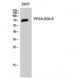 PPP2R5D Antibody - Western blot of PP2A-B56-delta antibody