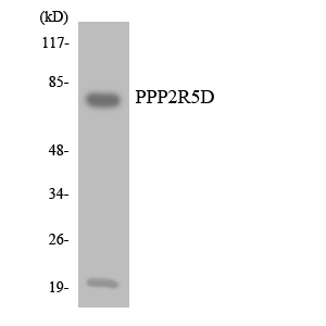 PPP2R5D Antibody - Western blot analysis of the lysates from HUVECcells using PPP2R5D antibody.