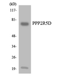 PPP2R5D Antibody - Western blot analysis of the lysates from HUVECcells using PPP2R5D antibody.