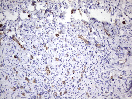 PPP2R5D Antibody - IHC of paraffin-embedded Human endometrium tissue using anti-PPP2R5D mouse monoclonal antibody. (Heat-induced epitope retrieval by 1 mM EDTA in 10mM Tris, pH8.5, 120°C for 3min).