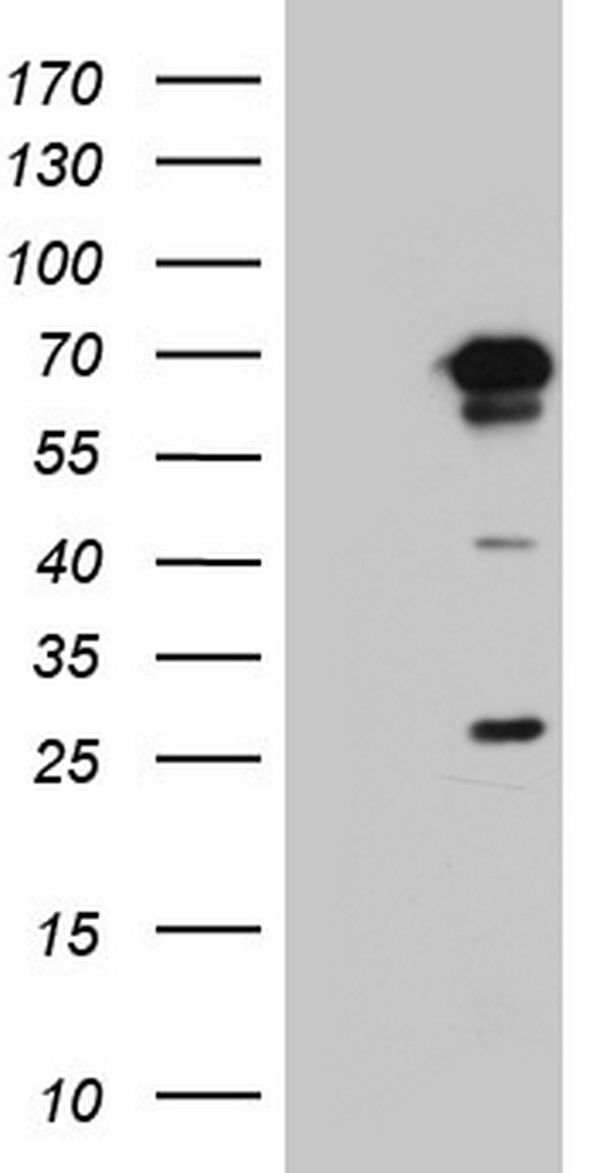 PPP2R5D Antibody - HEK293T cells were transfected with the pCMV6-ENTRY control (Left lane) or pCMV6-ENTRY PPP2R5D (Right lane) cDNA for 48 hrs and lysed. Equivalent amounts of cell lysates (5 ug per lane) were separated by SDS-PAGE and immunoblotted with anti-PPP2R5D.