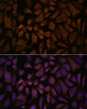 PPP2R5D Antibody - Immunofluorescence analysis of L929 cells using PPP2R5D Polyclonal Antibody at dilution of 1:100.Blue: DAPI for nuclear staining.