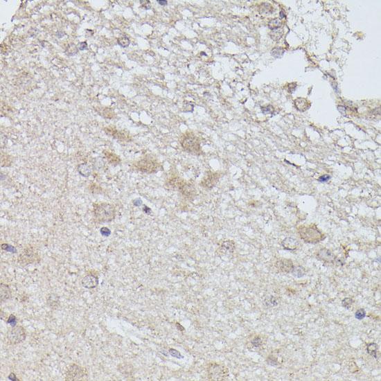 PPP2R5D Antibody - Immunohistochemistry of paraffin-embedded Rat brain using PPP2R5D Polyclonal Antibody at dilution of 1:100 (40x lens).