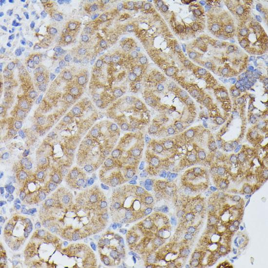 PPP2R5D Antibody - Immunohistochemistry of paraffin-embedded Mouse kidney using PPP2R5D Polyclonal Antibody at dilution of 1:100 (40x lens).