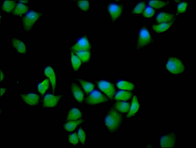 PPP2R5E Antibody - Immunofluorescence staining of Hela cells diluted at 1:166, counter-stained with DAPI. The cells were fixed in 4% formaldehyde, permeabilized using 0.2% Triton X-100 and blocked in 10% normal Goat Serum. The cells were then incubated with the antibody overnight at 4°C.The Secondary antibody was Alexa Fluor 488-congugated AffiniPure Goat Anti-Rabbit IgG (H+L).