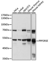 PPP2R5E Antibody - Western blot analysis of extracts of various cell lines, using PPP2R5E antibody at 1:1000 dilution. The secondary antibody used was an HRP Goat Anti-Rabbit IgG (H+L) at 1:10000 dilution. Lysates were loaded 25ug per lane and 3% nonfat dry milk in TBST was used for blocking. An ECL Kit was used for detection and the exposure time was 1s.