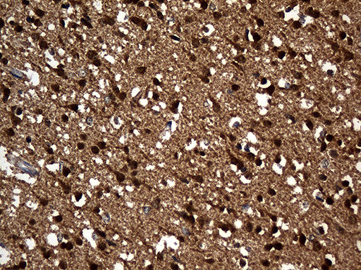 PPP3CA / CCN1 / Calcineurin A Antibody - Immunohistochemical staining of paraffin-embedded Human adult brain tissue within the normal limits using anti-PPP3CA mouse monoclonal antibody. (Heat-induced epitope retrieval by 1mM EDTA in 10mM Tris buffer. (pH8.5) at 120 oC for 3 min. (1:2000)