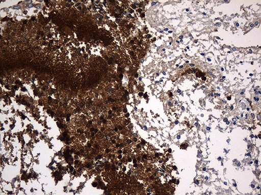 PPP3CA / CCN1 / Calcineurin A Antibody - Immunohistochemical staining of paraffin-embedded Human embryonic cerebellum within the normal limits using anti-PPP3CA mouse monoclonal antibody. (Heat-induced epitope retrieval by 1mM EDTA in 10mM Tris buffer. (pH8.5) at 120 oC for 3 min. (1:2000)