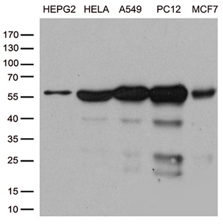 PPP3CA / CCN1 / Calcineurin A Antibody - Western blot analysis of extracts. (35ug) from cell lines by using anti-PPP3CA monoclonal antibody. (1:500)