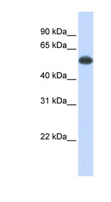 PPP3CA / CCN1 / Calcineurin A Antibody - PPP3CA / Calcineurin A antibody western blot of Fetal Muscle lysate.  This image was taken for the unconjugated form of this product. Other forms have not been tested.