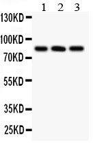PPP3CA / CCN1 / Calcineurin A Antibody - Calcineurin A antibody Western blot. All lanes: Anti Calcineurin A at 0.5 ug/ml. Lane 1: HELA Whole Cell Lysate at 40 ug. Lane 2: A549 Whole Cell Lysate at 40 ug. Lane 3: COLO320 Whole Cell Lysate at 40 ug. Predicted band size: 59 kD. Observed band size: 84 kD.