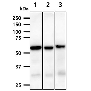 PPP3CA / CCN1 / Calcineurin A Antibody - The cell lysates (40ug) were resolved by SDS-PAGE, transferred to PVDF membrane and probed with anti-human PPP3CA antibody (1:1000). Proteins were visualized using a goat anti-mouse secondary antibody conjugated to HRP and an ECL detection system. Lane 1.: HeLa cell lysate Lane 1.: 293T cell lysate Lane 1.: LNCaP cell lysate