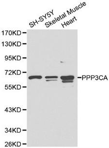 PPP3CA / CCN1 / Calcineurin A Antibody - Western blot of PPP3CA pAb in extracts from SH-SY5Y cells and mouse skeletal muscle, heart tissues.