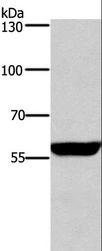 PPP3CA / CCN1 / Calcineurin A Antibody - Western blot analysis of Mouse brain tissue, using PPP3CA Polyclonal Antibody at dilution of 1:650.