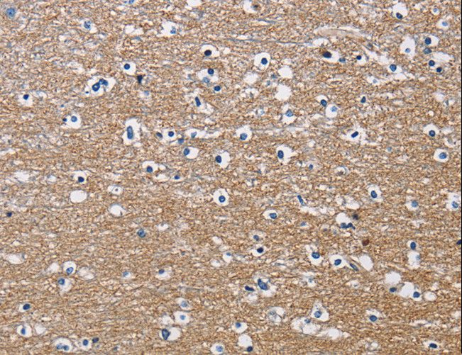PPP3CA / CCN1 / Calcineurin A Antibody - Immunohistochemistry of paraffin-embedded Human brain using PPP3CA Polyclonal Antibody at dilution of 1:30.