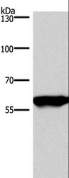 PPP3CA / CCN1 / Calcineurin A Antibody - Western blot analysis of Mouse brain tissue, using PPP3CA Polyclonal Antibody at dilution of 1:900.