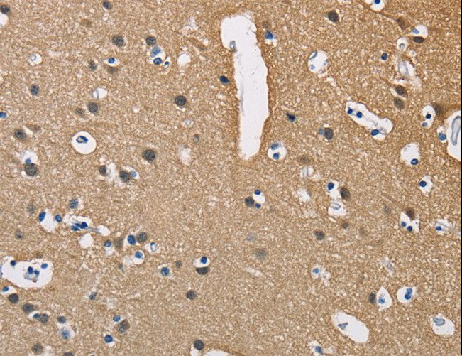 PPP3CA / CCN1 / Calcineurin A Antibody - Immunohistochemistry of paraffin-embedded Human brain using PPP3CA Polyclonal Antibody at dilution of 1:40.