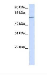 PPP3CA / CCN1 / Calcineurin A Antibody - 293T cell lysate. Antibody concentration: 1.0 ug/ml. Gel concentration: 12%.  This image was taken for the unconjugated form of this product. Other forms have not been tested.