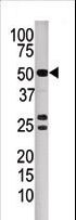 PPP3CB Antibody - Western blot of anti-PPP3CB antibody in mouse kidney tissue lysate. PPP3CB(arrow) was detected using the purified antibody.