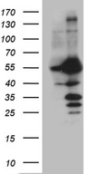 PPP3CB Antibody - HEK293T cells were transfected with the pCMV6-ENTRY control. (Left lane) or pCMV6-ENTRY PPP3CB. (Right lane) cDNA for 48 hrs and lysed. Equivalent amounts of cell lysates. (5 ug per lane) were separated by SDS-PAGE and immunoblotted with anti-PPP3CB. (1:2000)