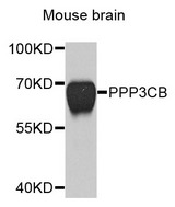 PPP3CB Antibody - Western blot analysis of extracts of mouse brain cells.