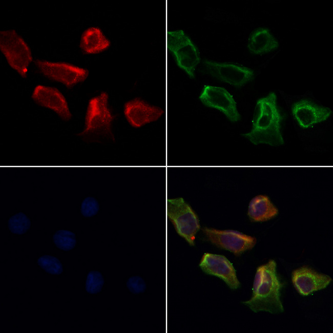 PPP3CB Antibody - Staining HeLa cells by IF/ICC. The samples were fixed with PFA and permeabilized in 0.1% Triton X-100, then blocked in 10% serum for 45 min at 25°C. Samples were then incubated with primary Ab(1:200) and mouse anti-beta tubulin Ab(1:200) for 1 hour at 37°C. An AlexaFluor594 conjugated goat anti-rabbit IgG(H+L) Ab(1:200 Red) and an AlexaFluor488 conjugated goat anti-mouse IgG(H+L) Ab(1:600 Green) were used as the secondary antibod