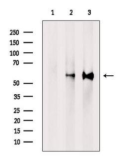PPP3CB Antibody