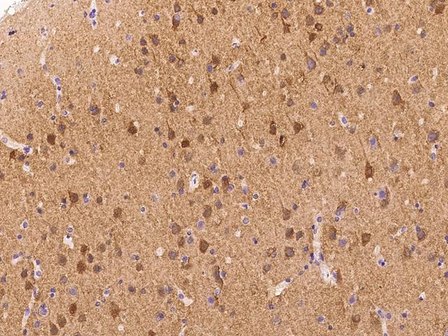 PPP3CB Antibody - Immunochemical staining of human PPP3CB in human brain with rabbit polyclonal antibody at 1:100 dilution, formalin-fixed paraffin embedded sections.
