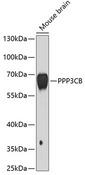 PPP3CB Antibody - Western blot analysis of extracts of mouse brain using PPP3CB Polyclonal Antibody at dilution of 1:1000.