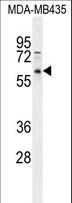 PPP3CC / CALNA3 Antibody - PPP3CC Antibody western blot of MDA-MB435 cell line lysates (35 ug/lane). The PPP3CC antibody detected the PPP3CC protein (arrow).