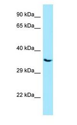 PPP3CC / CALNA3 Antibody - PPP3CC / CALNA3 antibody Western Blot of HepG2.  This image was taken for the unconjugated form of this product. Other forms have not been tested.
