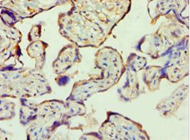 PPP3CC / CALNA3 Antibody - Immunohistochemistry of paraffin-embedded human placenta tissue using antibody at 1:100 dilution.
