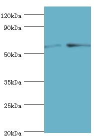 PPP3CC / CALNA3 Antibody - Western blot. All lanes: Serine/threonine-protein phosphatase 2B catalytic subunit gamma isoform antibody at 8 ug/ml. Lane 1: rat brain tissue. Lane 2: MCF-7 whole cell lysate. secondary Goat polyclonal to rabbit at 1:10000 dilution. Predicted band size: 58 kDa. Observed band size: 58 kDa.