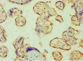PPP3CC / CALNA3 Antibody - Immunohistochemistry of paraffin-embedded human placenta using antibody at 1:100 dilution.