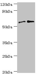 PPP3CC / CALNA3 Antibody - Western blot All lanes: Serine/threonine-protein phosphatase 2B catalytic subunit gamma isoform antibody at 8µg/ml Lane 1: Rat brain tissue Lane 2: MCF-7 whole cell lysate Secondary Goat polyclonal to rabbit IgG at 1/10000 dilution Predicted band size: 59, 58, 60 kDa Observed band size: 59 kDa