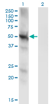 PPP3CC / CALNA3 Antibody - Western Blot analysis of PPP3CC expression in transfected 293T cell line by PPP3CC monoclonal antibody (M01), clone 4D1.Lane 1: PPP3CC transfected lysate (Predicted MW: 58.1 KDa).Lane 2: Non-transfected lysate.