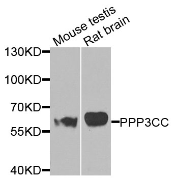 PPP3CC / CALNA3 Antibody - Western blot analysis of extracts of various cells.