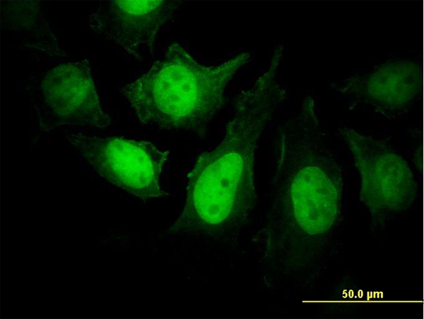 PPP3R1 / Calcineurin B Antibody - Immunofluorescence of monoclonal antibody to PPP3R1 on HeLa cell. [antibody concentration 25 ug/ml]