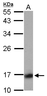 PPP3R1 / Calcineurin B Antibody - Sample (30 ug of whole cell lysate) A: IMR32 12% SDS PAGE PPP3R1 antibody diluted at 1:1000